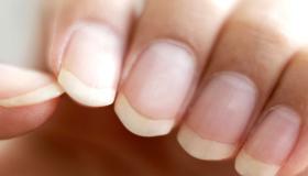 تفسير حلم الأظافر في المنام