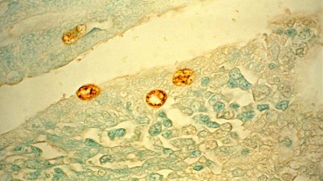 جراثيم البريمية تشخيصها وعلاجها