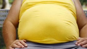 تفسير حلم الإصابة بالاستسقاء في المنام