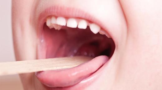 التهاب البلعوم واللوزتين| علاجه ومضاعفاته وكيفية الوقاية