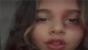 ابنة شيرين عبد الوهاب تكشف حقيقة تعرضها للضرب