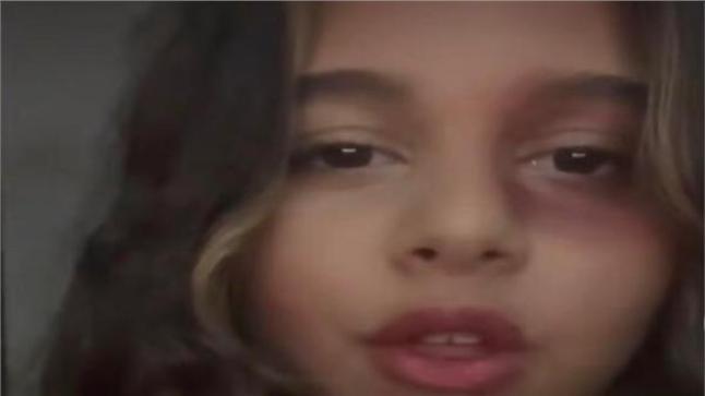 ابنة شيرين عبد الوهاب تكشف حقيقة تعرضها للضرب