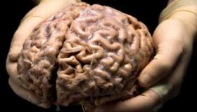 البريونات وما تحدثه من أمراض