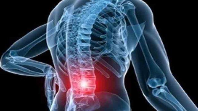 متلازمة تيتز