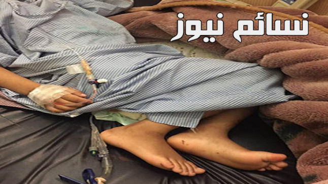 للمرة الثانية .. عملية جراحية جديدة لإيقاف نزيف الطفلة الباكستانية في الطائف