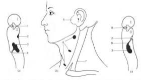 الغدانيات أسبابها وتشخصيها وطرق العلاج