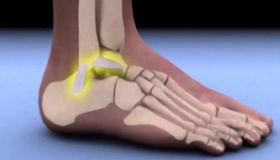 تفسير حلم كسر العظام في المنام