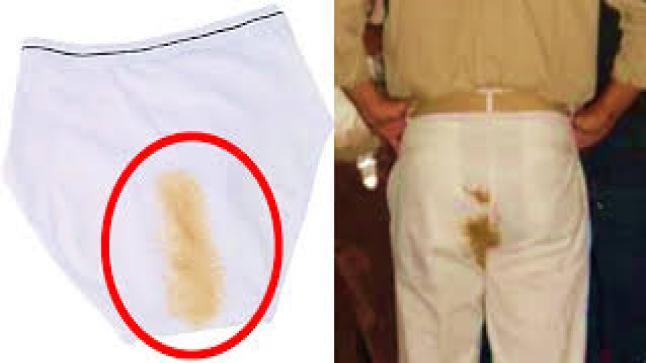 سلس البراز وأسبابه وكيفية تشخيصه