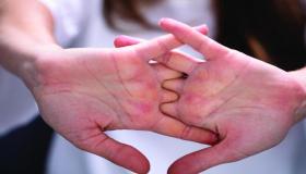 طقطقة الأصابع.. دراسات توضح هل هي عادة أم هوس مرضي؟