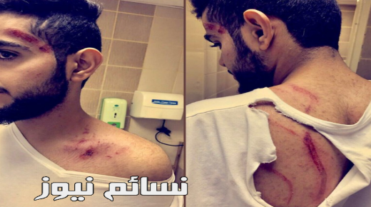 لبؤة مفترسة تهاجم شابا عشرينيا في منتزه رغدان بالباحة وتكاد تفتك به .. تعرف على التفاصيل ورواية الوالد