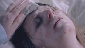 التيفوئيد وأعراضه وكيفية علاجه ومراحل العلاج