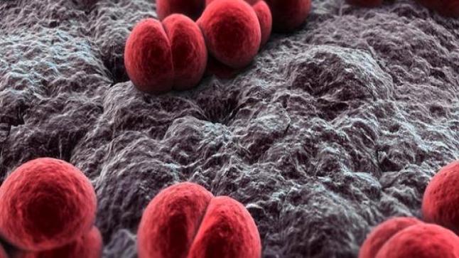 التهاب السحايا السلي | تشخيصه وعلاجه وكيفية الوقاية وطرق العدوى