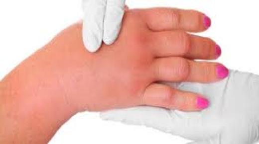 نقص صوديوم الدم أعراضه وأسبابه وطرق الوقاية منه