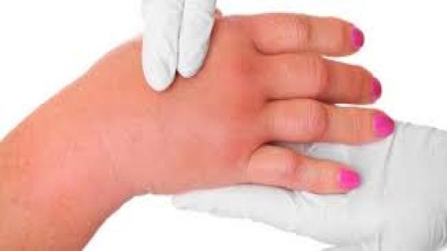 نقص صوديوم الدم أعراضه وأسبابه وطرق الوقاية منه